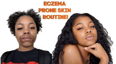 ECZEMA PRONE SKIN ROUTINE! HOW I CLEARED MY FACE! 6 1680772047 hqdefault