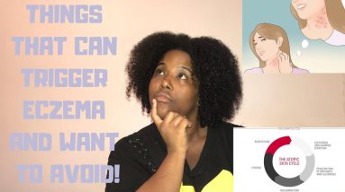 Things to AVOID to STOP eczema FLARE ups | Skincare Sunday 10 1680776815 maxresdefault