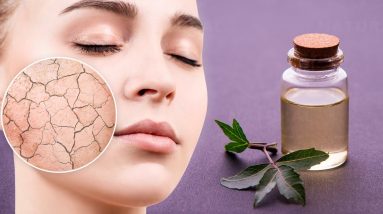 10 Wonderful Benefits and Uses of Neem Oil 4 1680778096 maxresdefault