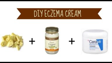 Eczema Cream (Kid Friendly) 20 1680779057 maxresdefault