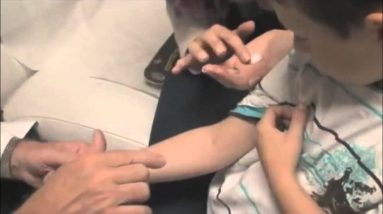 Eczema Treatment Options : How To Cure Eczema & Home Remedies For Eczema 8 1680787845 maxresdefault