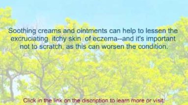 what cause eczema? read some causes eczema 14 1680791490 hqdefault