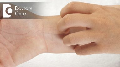 All about Eczema - Dr. Govind Mittal 10 1680792700 maxresdefault