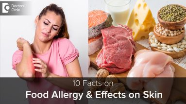 Food Allergy & how it affects SKIN | Causes, Symptoms & Treatment-Dr.Rajdeep Mysore |Doctors' Circle 20 1680800364 maxresdefault
