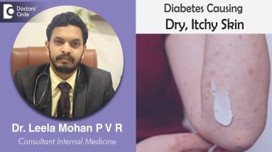 Oops!! Dry, Itchy Skin in Diabetes- Know Why ??? Causes, Symptoms, & Treatment-Dr. Leela Mohan P V R 8 1680803889 maxresdefault