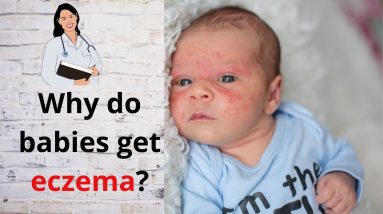 How to get rid of eczema in babies👶 This works!! 14 1680812688 maxresdefault