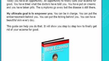 Eczema -eczema causes in children - Must see 10 1680813870 hqdefault