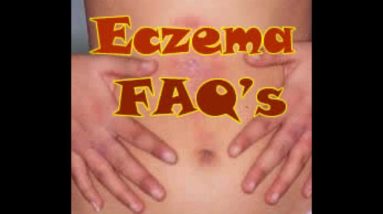 Eczema Causes Frequently Asked Questions - Eczema Causes FAQ 16 1680817562 maxresdefault