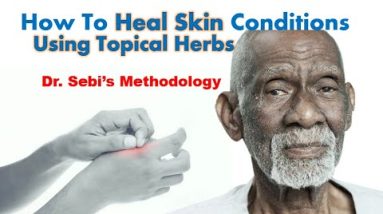 Topical Herbal Skin Treatments - Dr. Sebi Methodology 10 1680819139 hqdefault