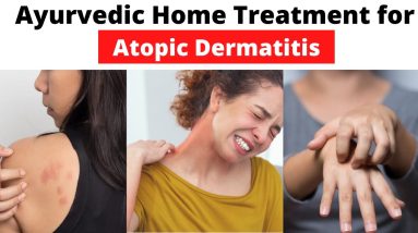 ATOPIC DERMATITIS or Eczema AYURVEDIC Home Treatment 6 1680820154 maxresdefault
