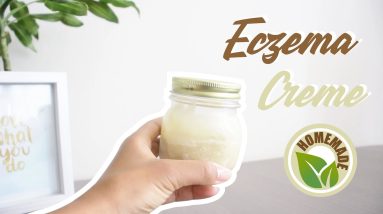 How to Get Rid of Eczema Itch and Dry Patches Naturally | DIY Vegan Eczema Cream 12 1680823817 maxresdefault