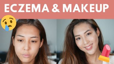 My Eczema Journey and How to Apply Makeup on Flare Up Days 10 1680824410 maxresdefault