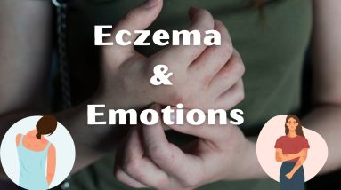 Eczema and Your Emotions | Dermatology 14 1680828805 maxresdefault