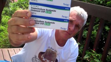The Only Medicine that Cured my Eczema! Triamcinolone Acetonide cream usp 0.1 6 1680830514 maxresdefault