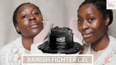 BEST PRODUCT FOR ACNE, PIMPLES & ECZEMA DRY SKIN | BANISH FIGHTER GEL | byalicexo 2 1680831970 maxresdefault