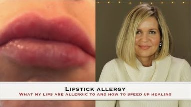 Lipstick Allergy - What I am allergic to and how to speed up healing 20 1680837625 hqdefault