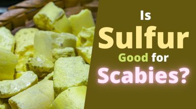 Sulfur for Scabies - Is it Good, How to Use Sulfur Ointment to Help with Scabies? 6 1680841308 maxresdefault