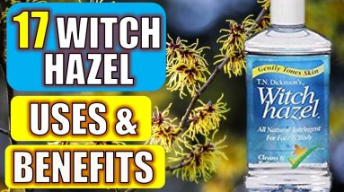 17 Surprising Witch Hazel Benefits & Uses (HEALTH | BEAUTY | CLEANING) 18 1680848768 maxresdefault