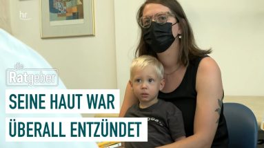 Schwere Neurodermitis: Wie ein Medikament Rubens Leben veränderte | Gesundmacher 4/5 | die Ratgeber 6 1680852248 maxresdefault