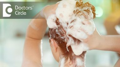 How to manage fungal infection on scalp? - Dr. Nischal K 4 1680852443 maxresdefault