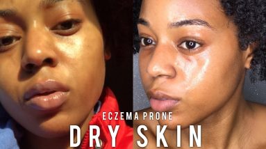 Radiant Everyday Skin Care Routine | Very Dry Skin + Eczema | Bria Katana 2 1680853053 maxresdefault