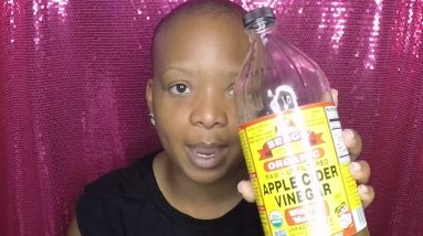 ECZEMA | HOW I NATURALLY CLEARED IT UP IN 4 DAYS | SKINCARE ROUTINE FOR ECZEMA 10 1680861857 maxresdefault