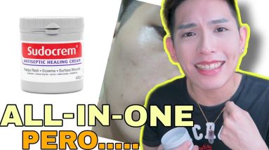 NAGBREAKOUT AKO! SUDOCREM FOR ACNE, ECZEMA, INSECT BITES, BABY RASHES | FINAL THOUGHTS 2 1680863685 maxresdefault