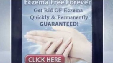 What Are the Dyshidrotic Eczema Causes? 14 1680865884 hqdefault