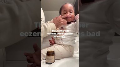 💔ECZEMA TRIGGERS💔#eczema #eczemarelief #eczemaproblems #eczemahealing #shorts #babyeczema #dryskin 6 1680868012 maxresdefault