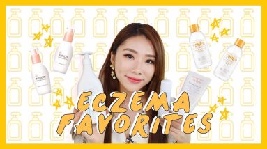 PRODUCTS I USE ON MY ECZEMA SKIN | MONGABONG 18 1680875432 maxresdefault