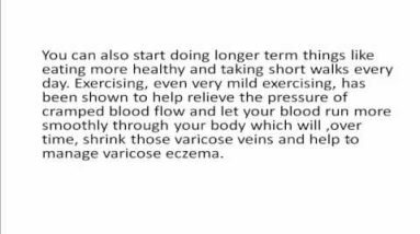 Varicose Eczema Treatment 18 1680880660 hqdefault