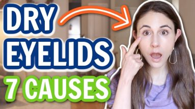 7 REASONS FOR DRY EYELIDS | Dermatologist @DrDrayzday 18 1680886266 maxresdefault