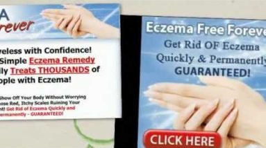 Top 10 Eczema Cream for Babies and Toddlers 16 1680886542 hqdefault