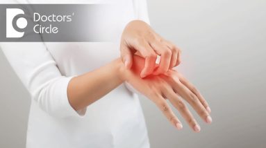 Homeopathic medications for treating skin allergies - Dr. Karagada Sandeep 6 1680889762 maxresdefault