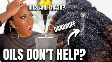 Oils DON'T Help Dry Scalp & Dandruff? | Black Hair 4 1680890072 maxresdefault
