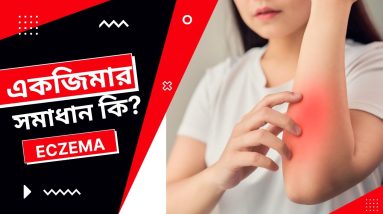 Eczema problem remove | Eczema Symptoms and Solution | Atopic Dermatitis 16 1680891715 maxresdefault