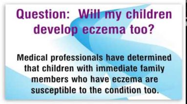What Causes Eczema: Frequently Asked Questions about Eczema Causes 18 1680907565 hqdefault