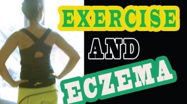 Why Exercising Benefits Eczema 2 1680912233 hqdefault