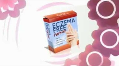 Stress Related Eczema Cause -- Shocking Revelations 18 1680917933 hqdefault