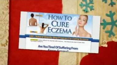 Eczema In Toddlers : 2 Low Cost Eczema Treatments That Work 8 1680921267 hqdefault