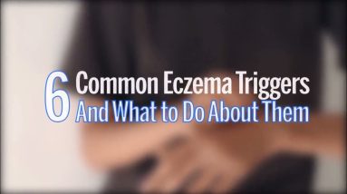 6 common eczema triggers and what to do about them 2 1680922643 maxresdefault