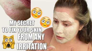 GET RID OF SKIN RASHES ON FACE | Allergic reaction 18 1680924091 maxresdefault