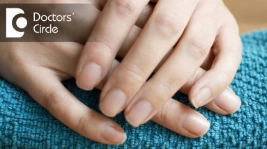 Causes and management of dry itchy fingertips intolerable to heat - Dr. Nischal K 4 1680927764 maxresdefault