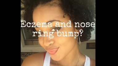 How to Get Rid Of Eczema and Nose Ring Bump/Keloids 18 1680928759 maxresdefault