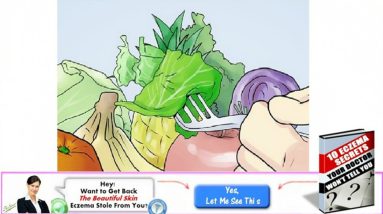 Eczema Diet - What To Take Out & Put In (MUST SEE!) 16 1680928944 maxresdefault