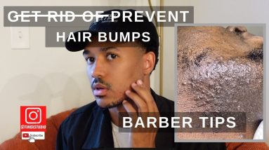 How to Get Rid of Hair Bumps Razor Bumps, Ingrown Hairs or Pseudofolliculitis 10 1680931429 maxresdefault