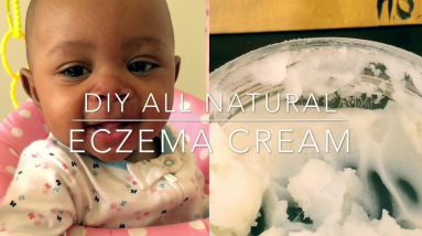 DIY All Natural Eczema Cream | Itch Relief 8 1680932071 maxresdefault