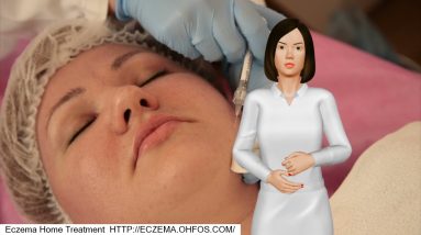 Can Ringworm Cause Eczema 2 1680932833 maxresdefault