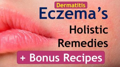 Eczema, dermatitis and Holistic Remedies. Dr Ali - Naturopath Birmingham UK 18 1680934689 maxresdefault