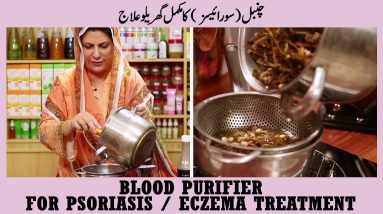 Psoriasis (Chambal) and Eczema Treatment || Blood Purifier Drink for Psoriasis by Dr. Bilquis Shaikh 10 1680936379 maxresdefault